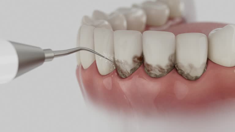 Trusted Teeth Cleaning And Checkup service in Glen Carbon, IL - Dentist Open Now